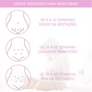 Monitor Sonar Doppler Fetal